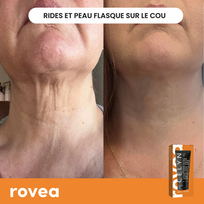 Crème Anti Cernes et Rides Instantanée