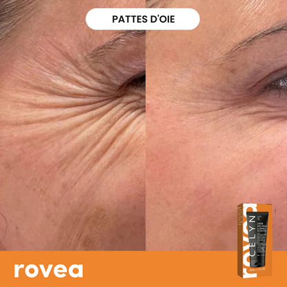 Crème Anti Cernes et Rides Instantanée