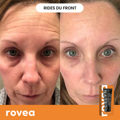 Crème Anti Cernes et Rides Instantanée